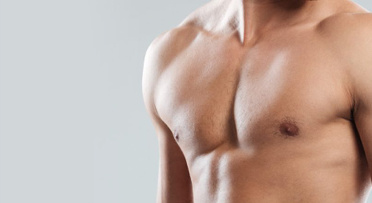 Ginecomastia redução de mamas homens - Cirurgia plástica em Joinville - Clínica Bertoli Joinville