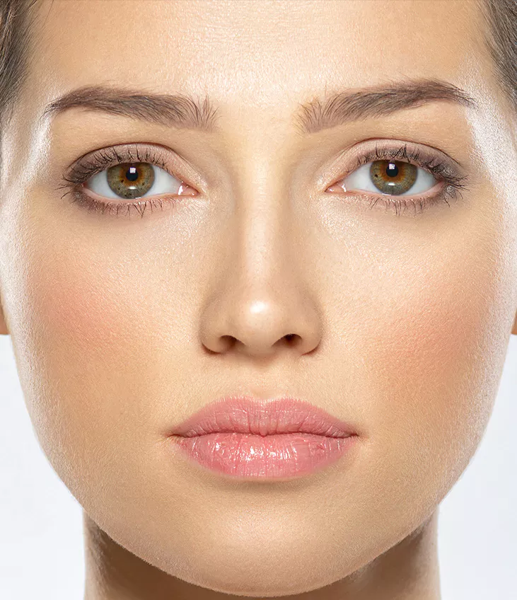 Preenchimento facial em Joinville